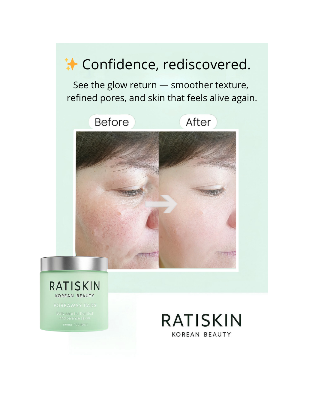 RATISKIN POREAWAY PADS