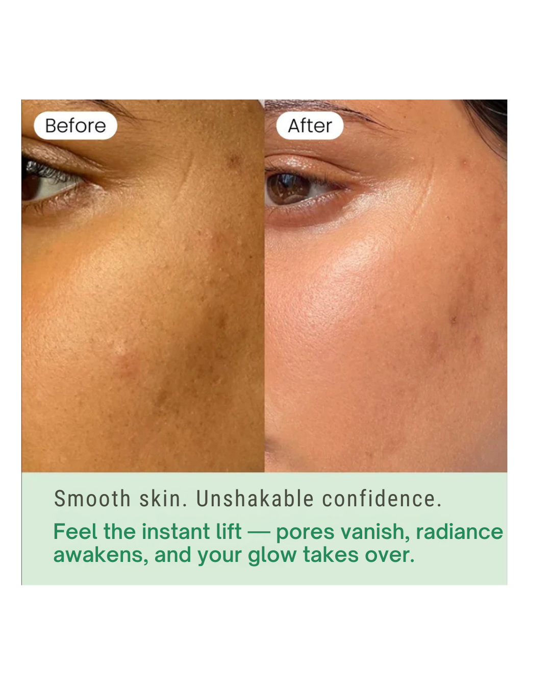 RATISKIN POREAWAY PADS