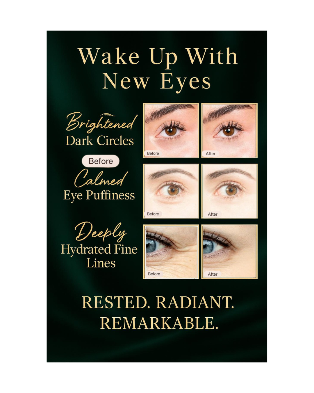 RATISKIN COLLAGEN EYE PATCHES